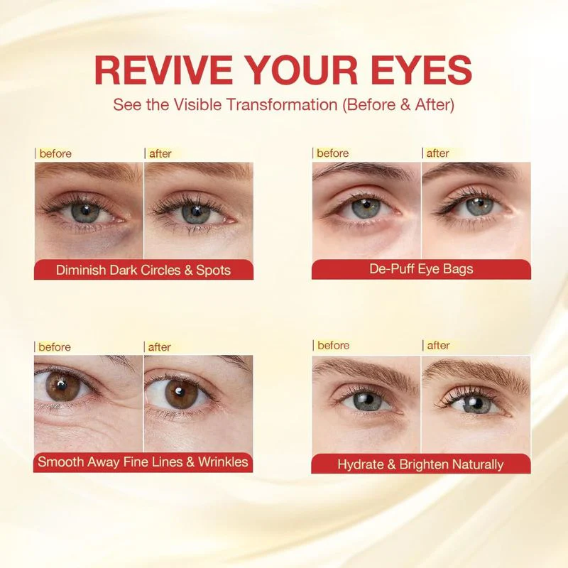 360° Eye Mask - Erases Puffiness, Dark Circles & Crepey Lids - Image 5