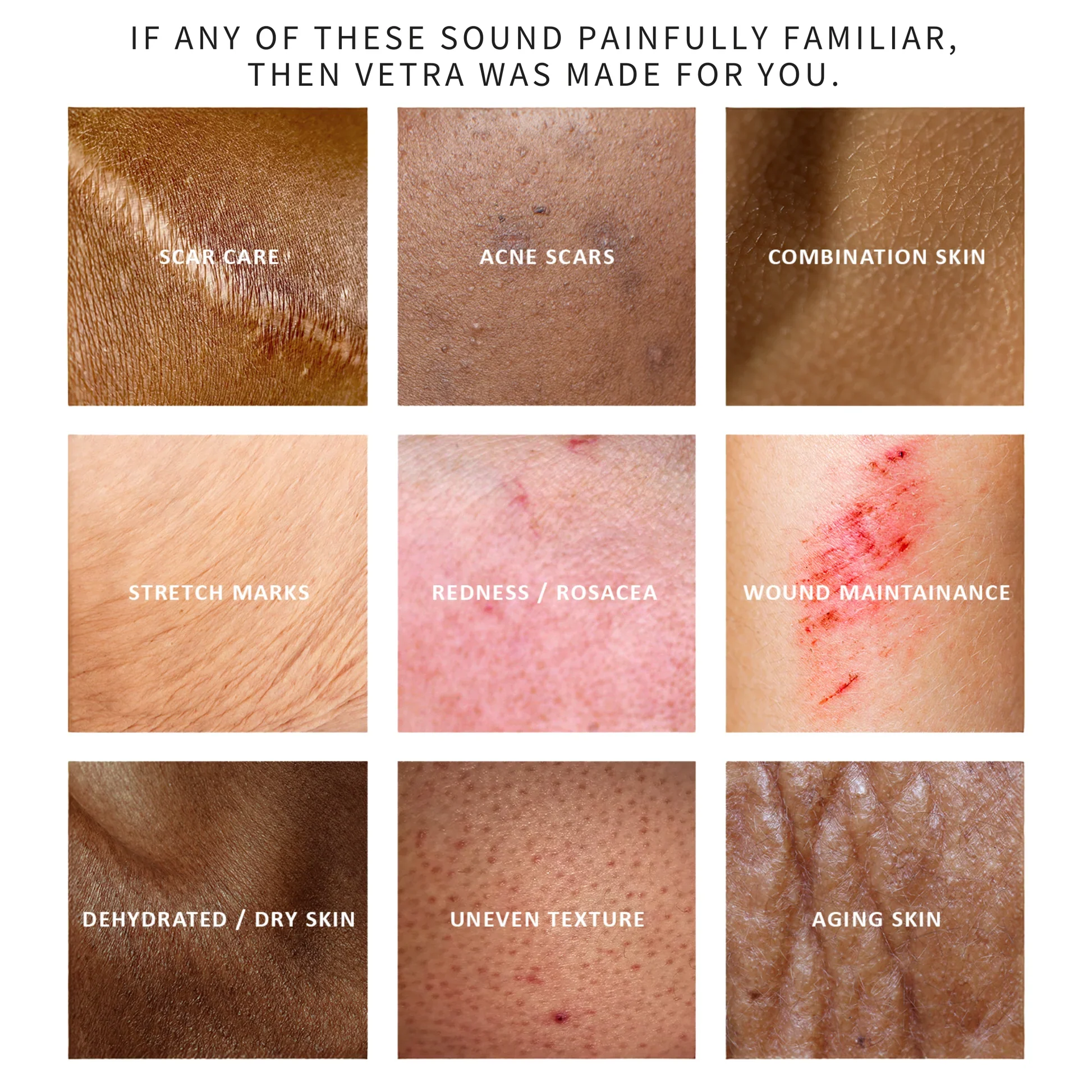 Silicone Scar Stick By Glow Heaven - Image 3